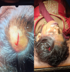 वीरगन्जमा पानीको विषयलाई लिएर विवाद, दुई महिला गम्भीर घाइते