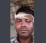 सामान्य विवादमा कानुमाथि कुटपिट, वडाध्यक्षका छोरासहित ३ जनाविरुद्ध जाहेरी