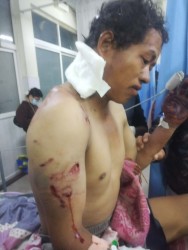 भालुको आक्रमणबाट स्थानीय एक युवक घाइते  