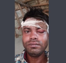 सामान्य विवादमा कानुमाथि कुटपिट, वडाध्यक्षका छोरासहित ३ जनाविरुद्ध जाहेरी