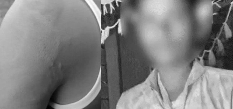 दलित विद्यार्थीले पानीको बोतल छोएको भन्दै शिक्षकले गरे कुटपिट