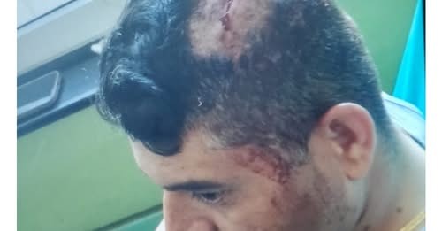 काठमाडौंको बानेश्वरमा प्रहरी र प्रदर्शनकारीबीच झडप, डीएसपी घाइते