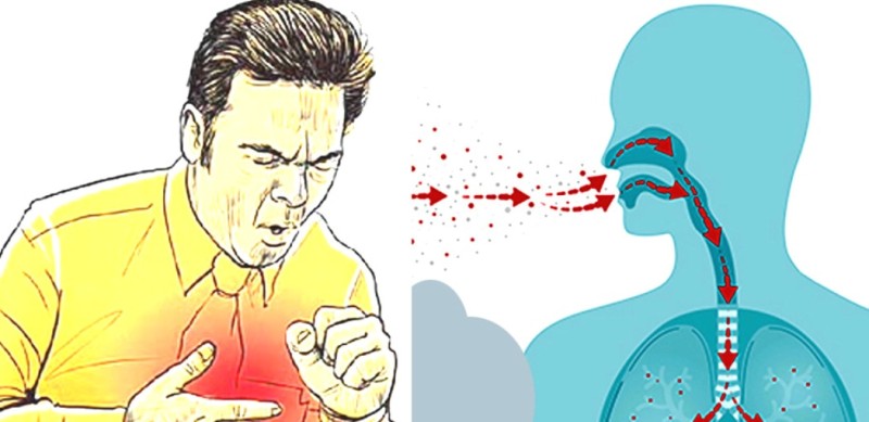 मोरङमा क्षयरोग संक्रमण र मृत्युदर दुवै बढ्दो, नियन्त्रणमा चुनौती